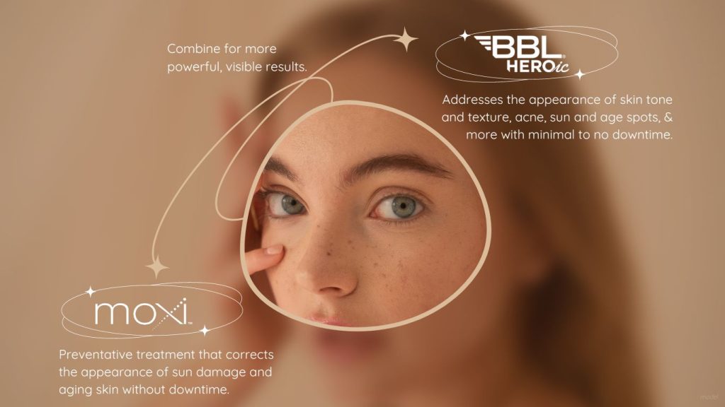 BBL HEROic and Moxi information with model image of a woman with freckles touching her face. 